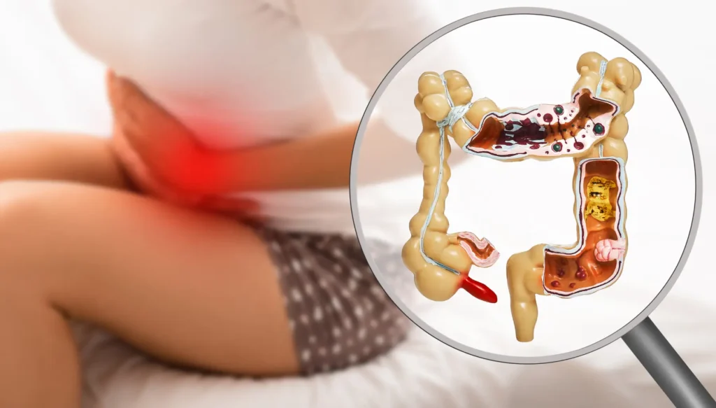 Entendendo a Relação entre Intestino e Emagrecimento