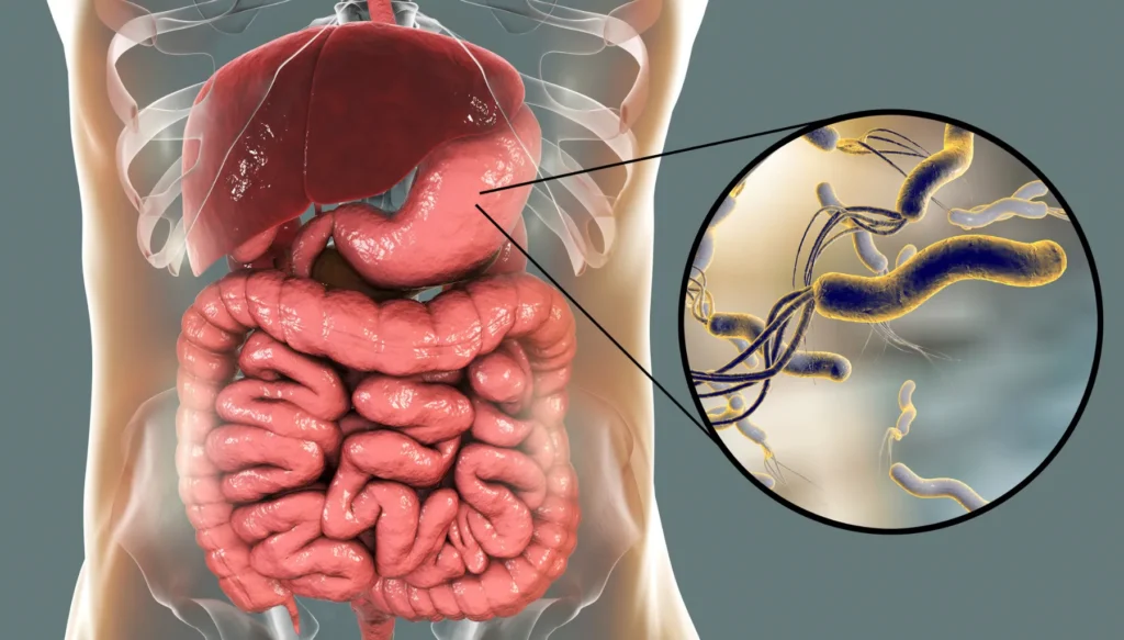 7 Remédios Naturais Para H. Pylori