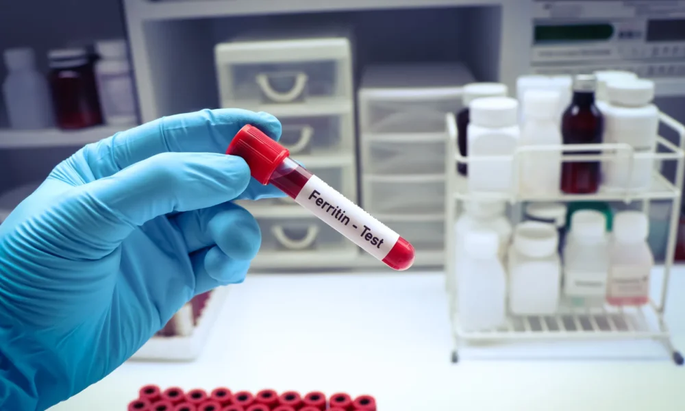 Ferritina alta como controlar com alimentação